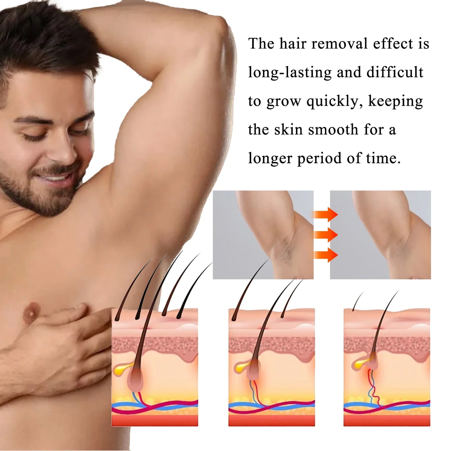 Men's Body Hair Removal Cream – Chest, Arm, Leg & Back