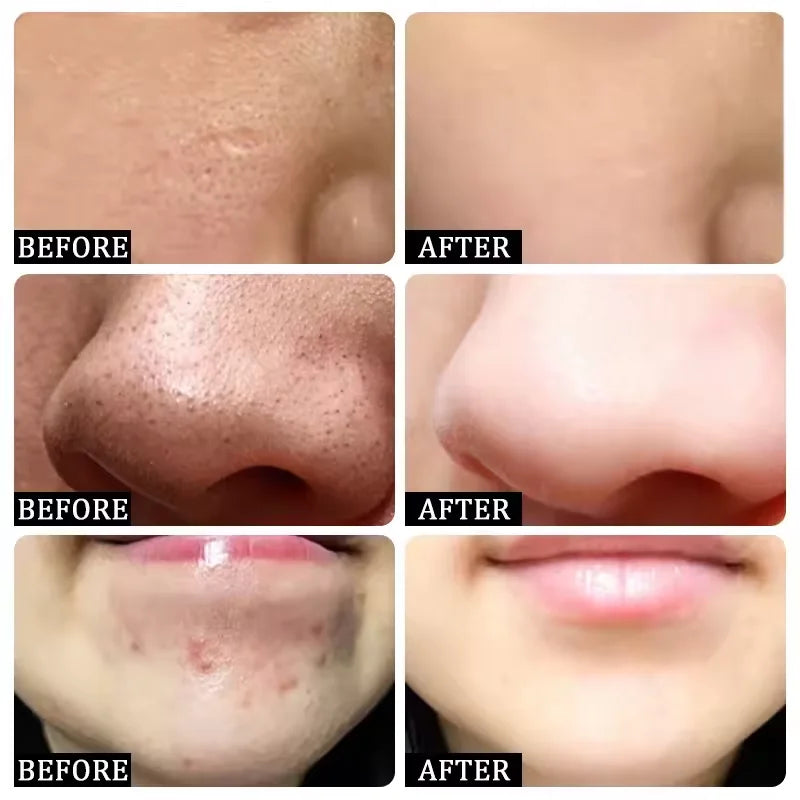 Pore Shrinking Cream Elimination Large Pores Blackehead Remove Acne Pit Repair Gel Tighten Face Smooth Skin Korean Care Products Peaceful Pleasures Health and Wellness