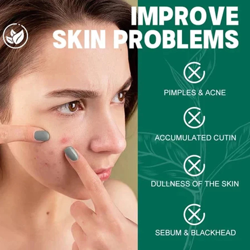 SOME BY MI 30 Days Miracle Toner 150ml/Acne Clear Foam 100ml /60ml Face Cream for Oily Acne-Prone Skin Korean skincare set Peaceful Pleasures Health and Wellness