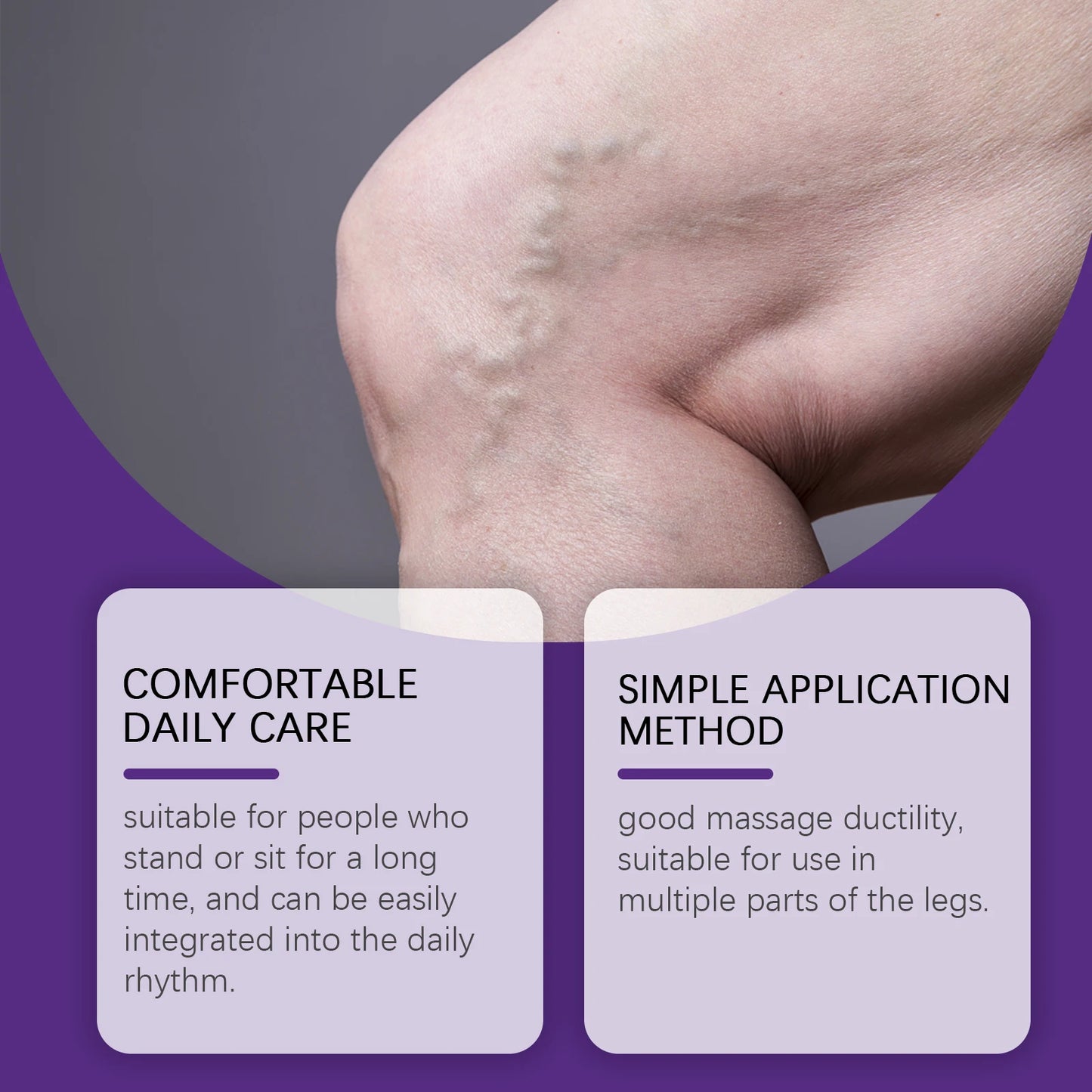 Varicose Vein Treatment Cream Relieve Leg Fatigue Reduce Phlebitis Promote Circulations Blood Repair Barriers Body Care Cream Peaceful Pleasures Health and Wellness