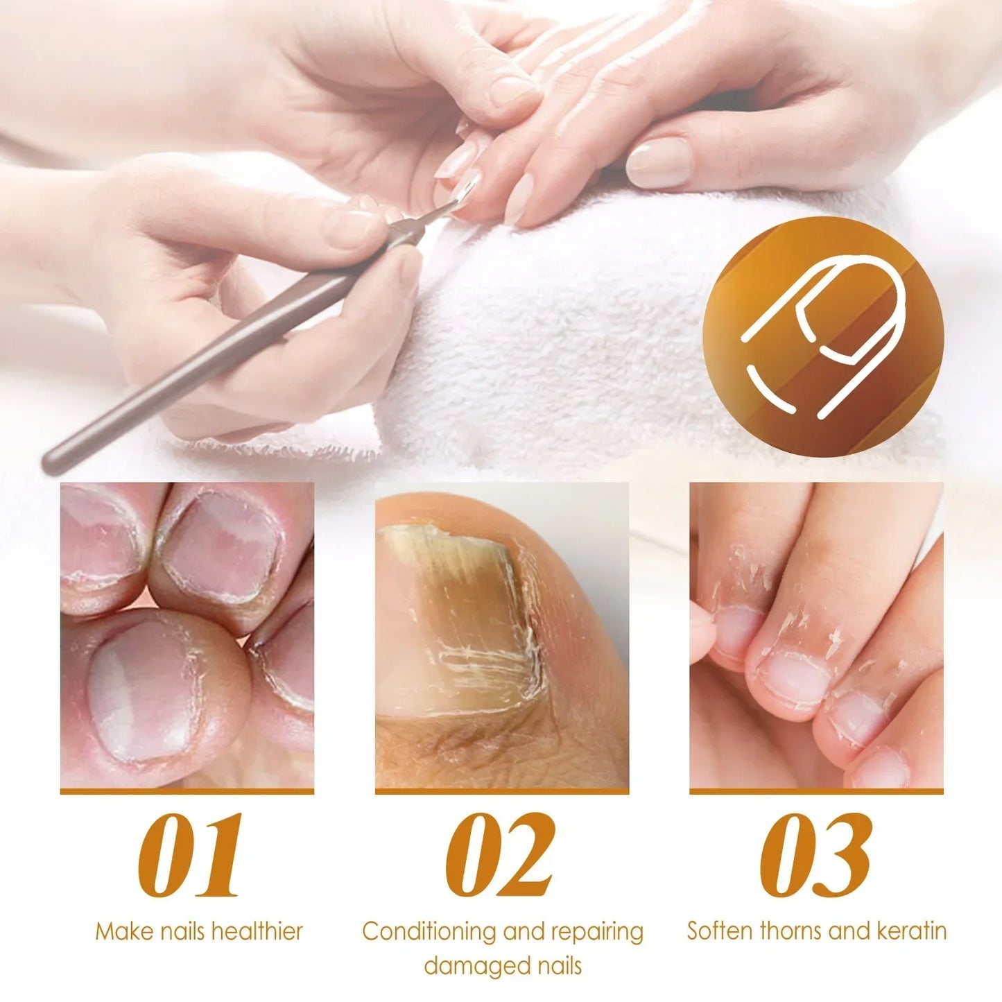 EELHOE Cuticle Removal Gel – Nail Softener & Dead Skin Remover