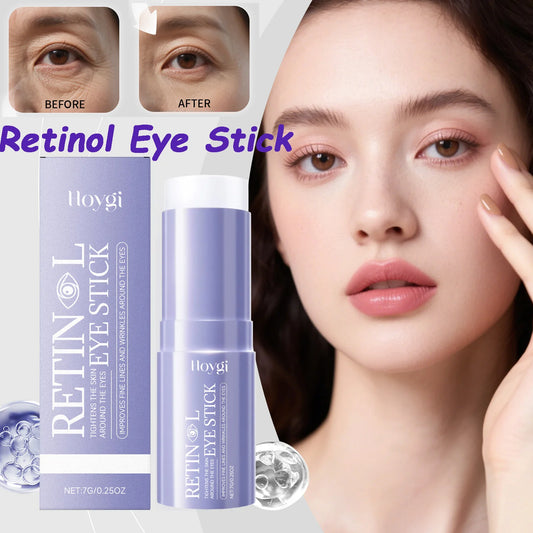 Retinol Eye Cream Stick – Dark Circles, Puffiness & Wrinkles