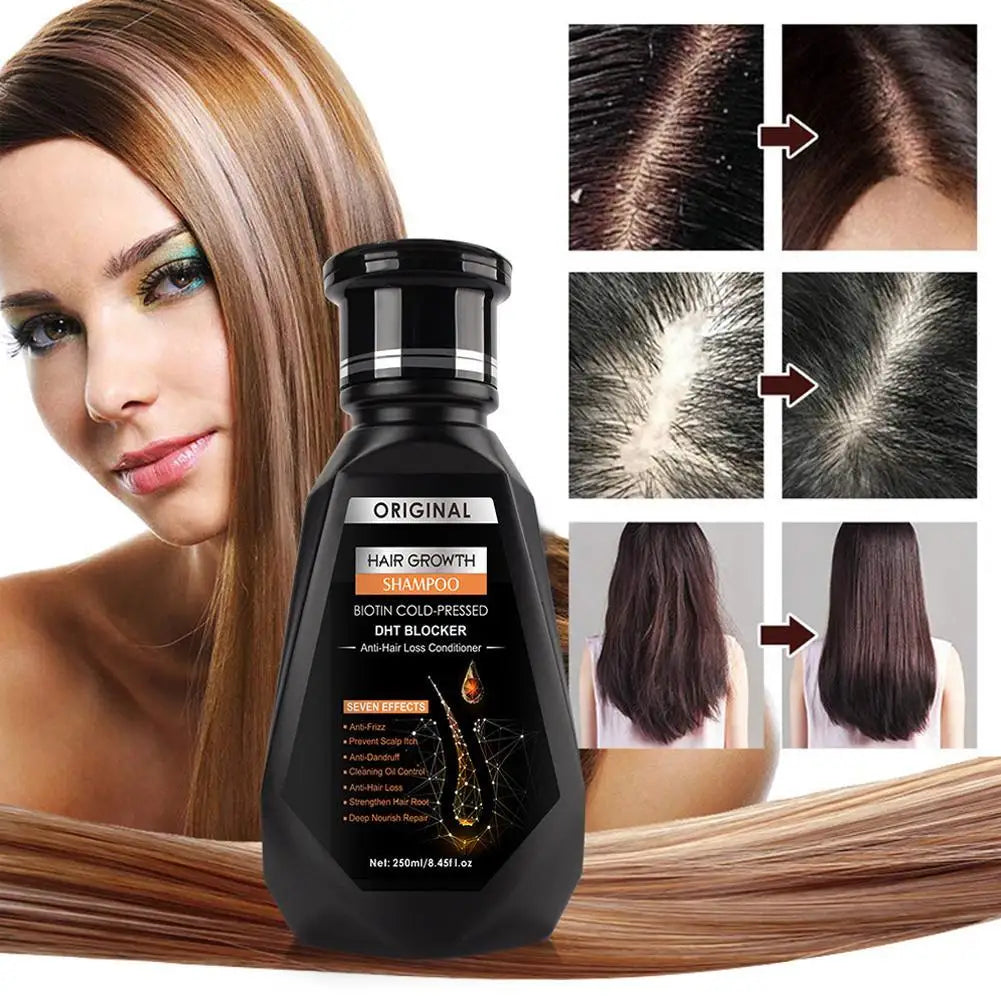 Ginger Hair Growth Shampoo Deep Cleaning Relieves Itching Stimulates Hair Follicles and Accelerates Hair Growth Shampoo Peaceful Pleasures Health and Wellness