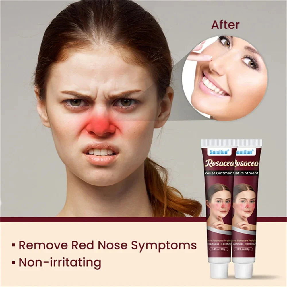 Korean Facial Redness Repair Cream | Sensitive Skin 30g