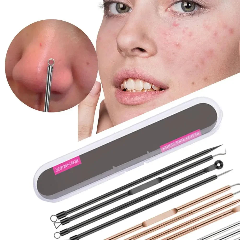 4-Piece Blackhead Remover Tool Set – Stainless Steel Peaceful Pleasures Health and Wellness