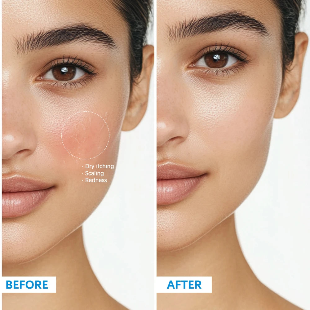 Soothing Multi-Purpose Hydrating Cream Reduces Redness Daily Helps Relieve Rough Cracked Skin Deep Skin Care Peaceful Pleasures Health and Wellness