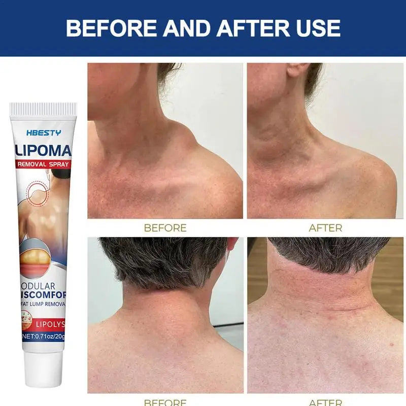 Herbal Skin Smoothing Cream – Fat Bulge & Lump Care 20g