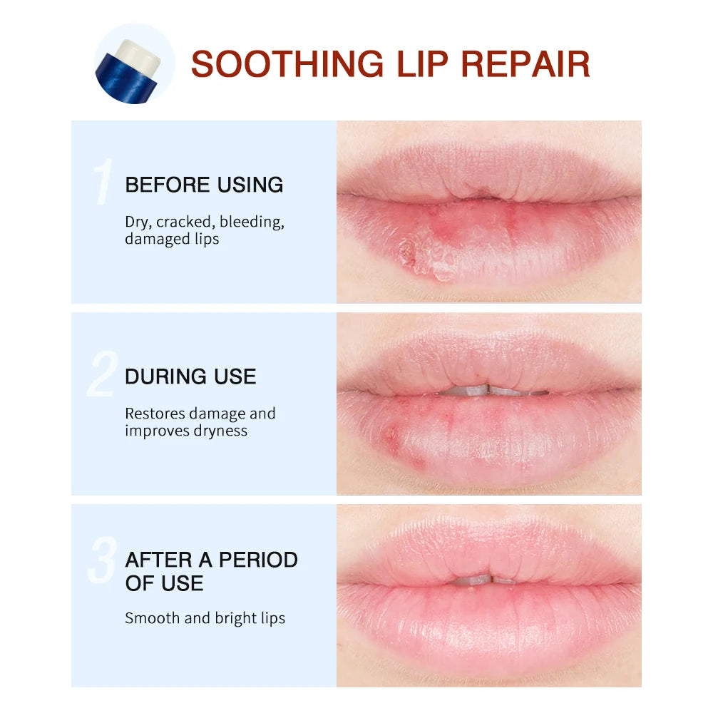 Lakerain Lip Repair Stick 2 Packs Quick Relief Of Dry Moisturizing And Smoothing lip Lines Lip Balm Soothes Chapping Lipstick Peaceful Pleasures Health and Wellness
