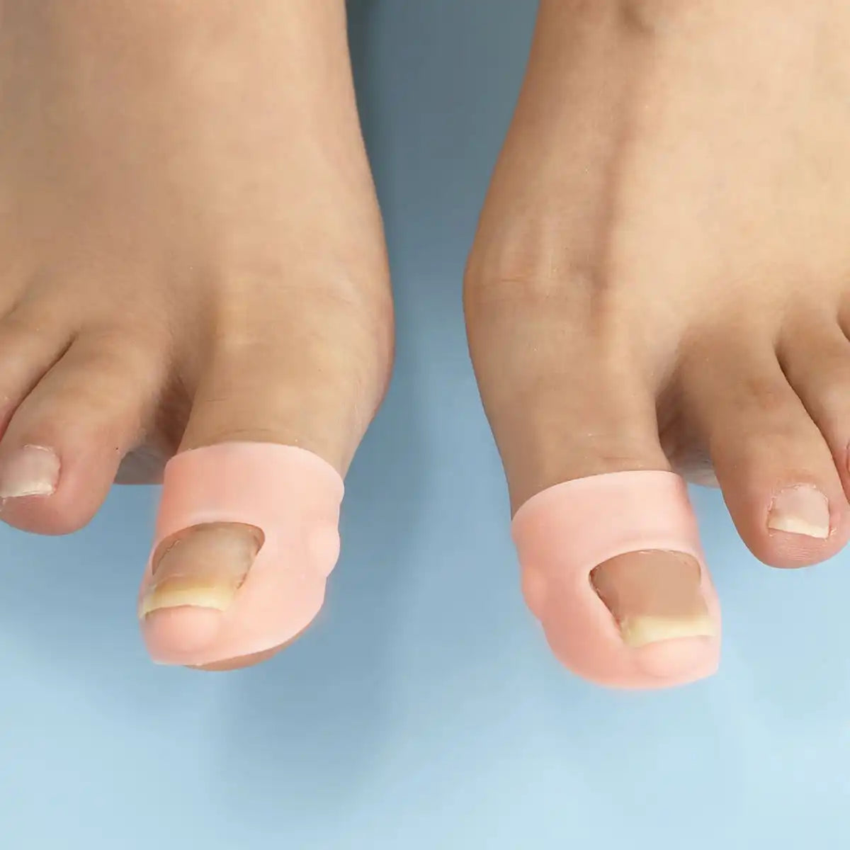 Silicone Ingrown Toenail Protector Cover – 2pcs Nail Guard
