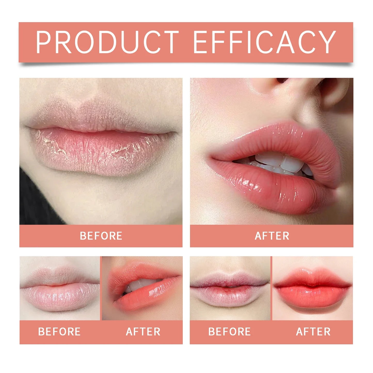 Eelhope Fruity Strawberry Lip Balm – Deep Moisture All Seasons