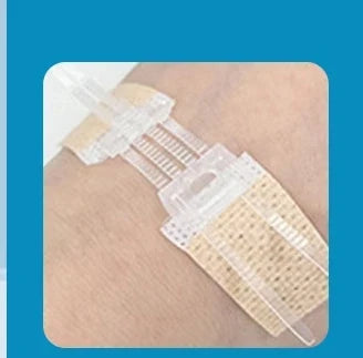 Zipper Wound Closure Strips | No-Suture Fast Closure Patch