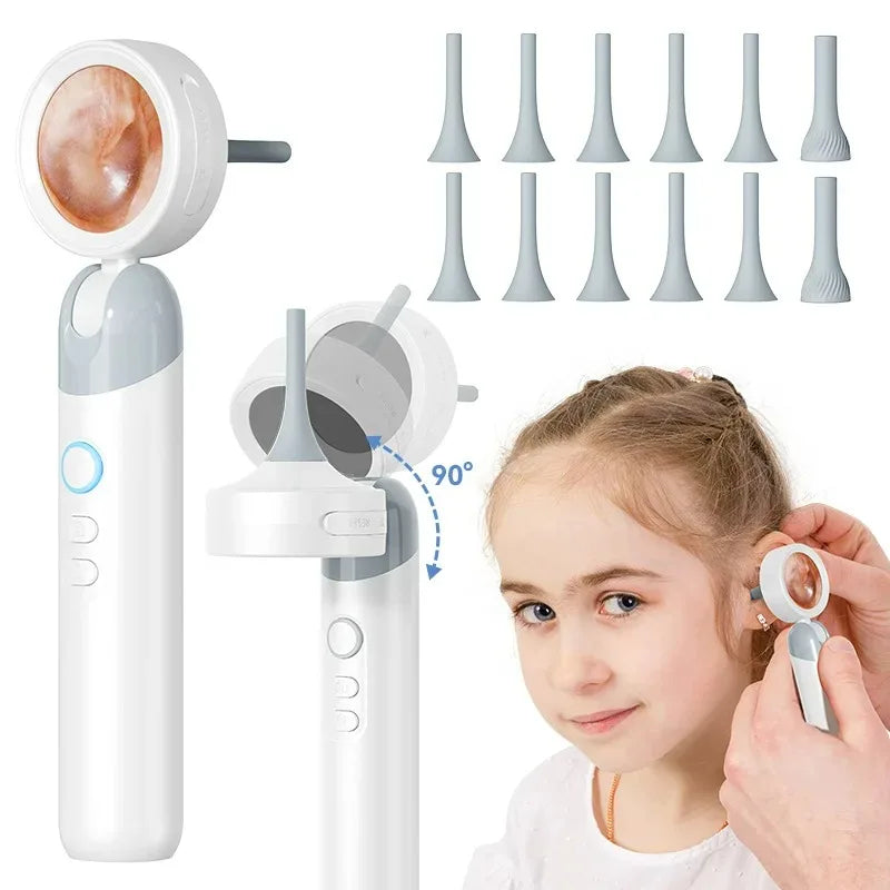 1.38'' Ear Camera Wit IPS Display and 1080P Camera Ear Check Portable Inspector for Ear Mouth Pet With 12tips Replaceable Tools Peaceful Pleasures Health and Wellness White A