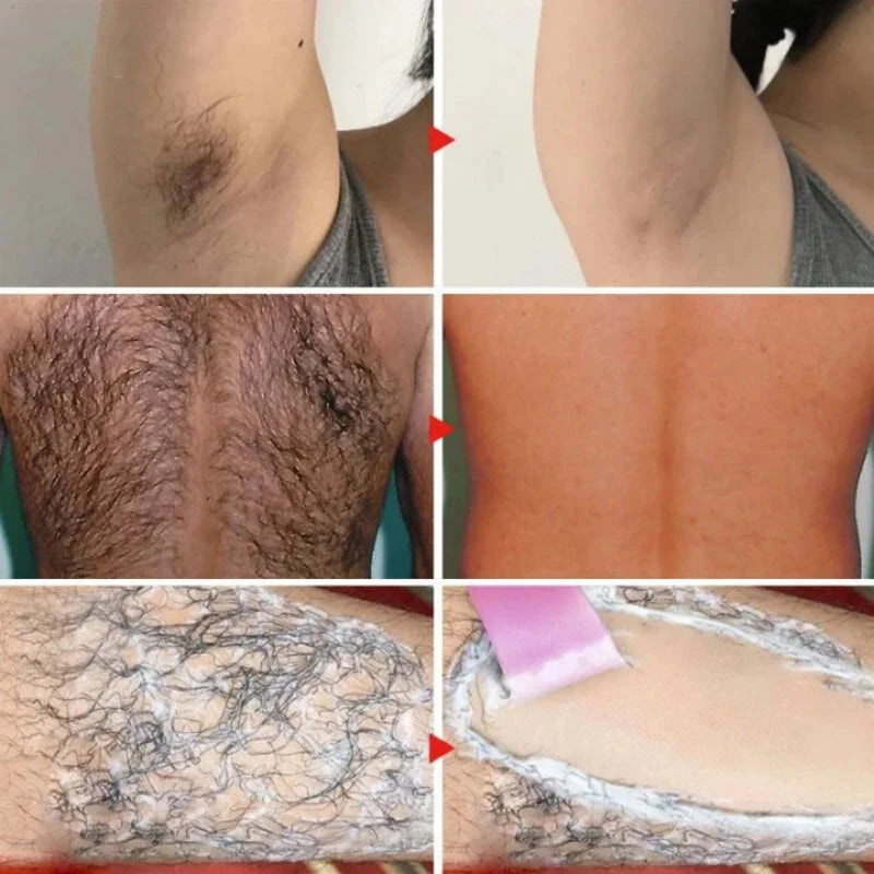 BIOAOUA Aloe Vera Hair Removal Cream – Gentle Body Depilatory