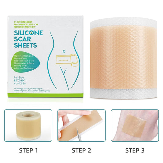 1/2Rolls 4cmx150cm Silicone Scar Sheets Removal Strips Silicone Gel Strip Acne Keloid Surgery Burn Treatment Scar Patch NO B Peaceful Pleasures Health and Wellness