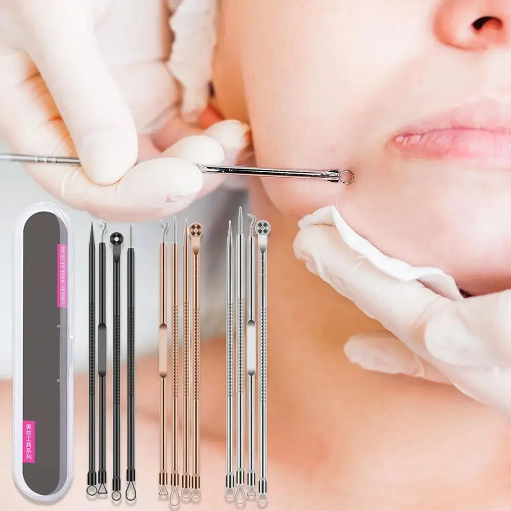 4-Piece Blackhead Remover Tool Set – Stainless Steel Peaceful Pleasures Health and Wellness
