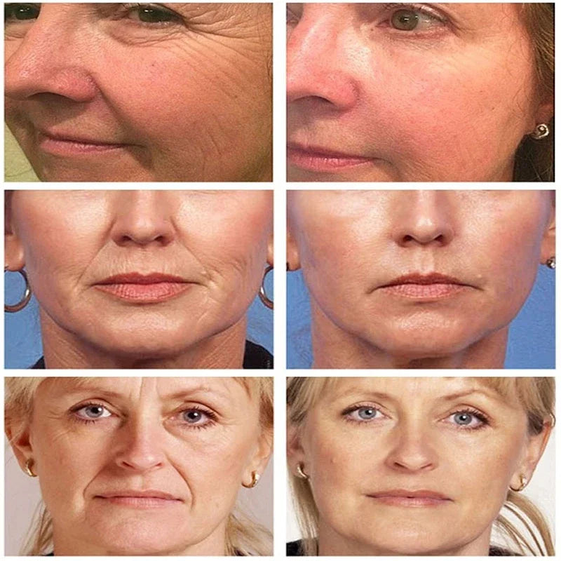 B3 Peptide Remove Wrinkle Serum Firming Lifting Anti-Aging Fade Fine Lines Face Essence For Treatment Facial lines Forehead Car Peaceful Pleasures Health and Wellness