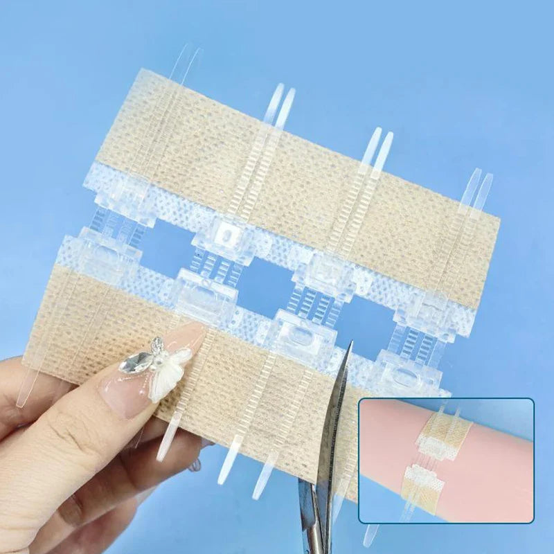 Zipper Wound Closure Strips | No-Suture Fast Closure Patch