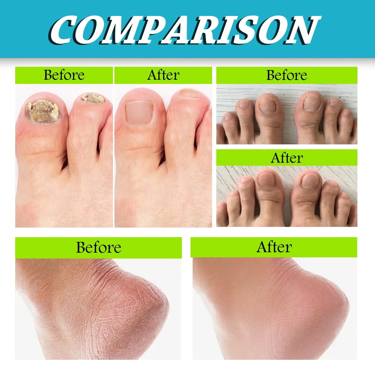 Foot Moisturizing Spray | Glycerin & Sophora Root Hydrating Mist