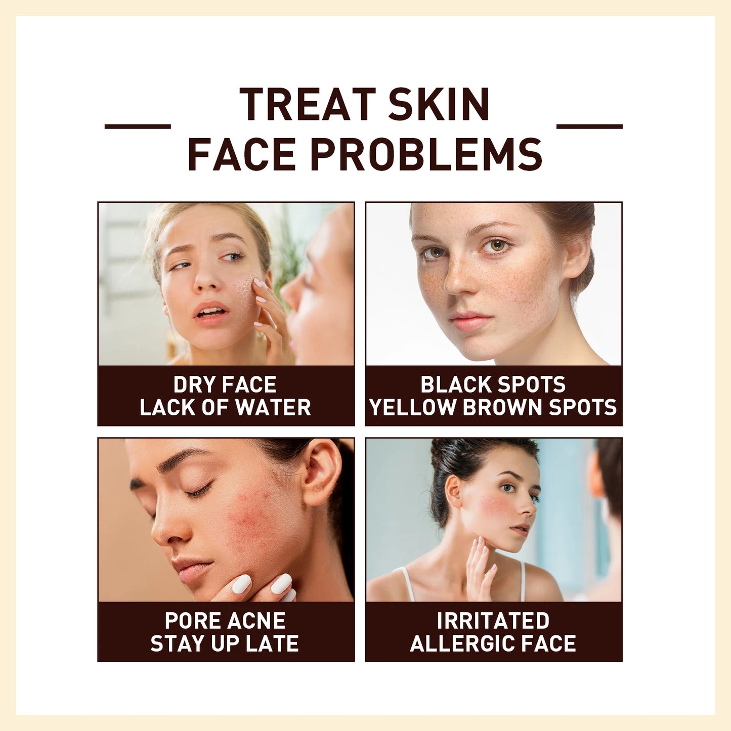 Rice Face Serum – Brightening, Anti-Wrinkle & Pore-Minimizing