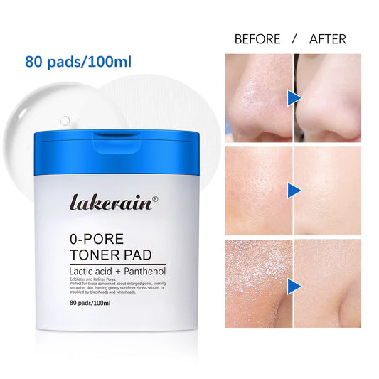 Zero Pore Toner Pads – Oil Control, Exfoliate & Refine Pores Exfoliating Toner Pads Oasis Select