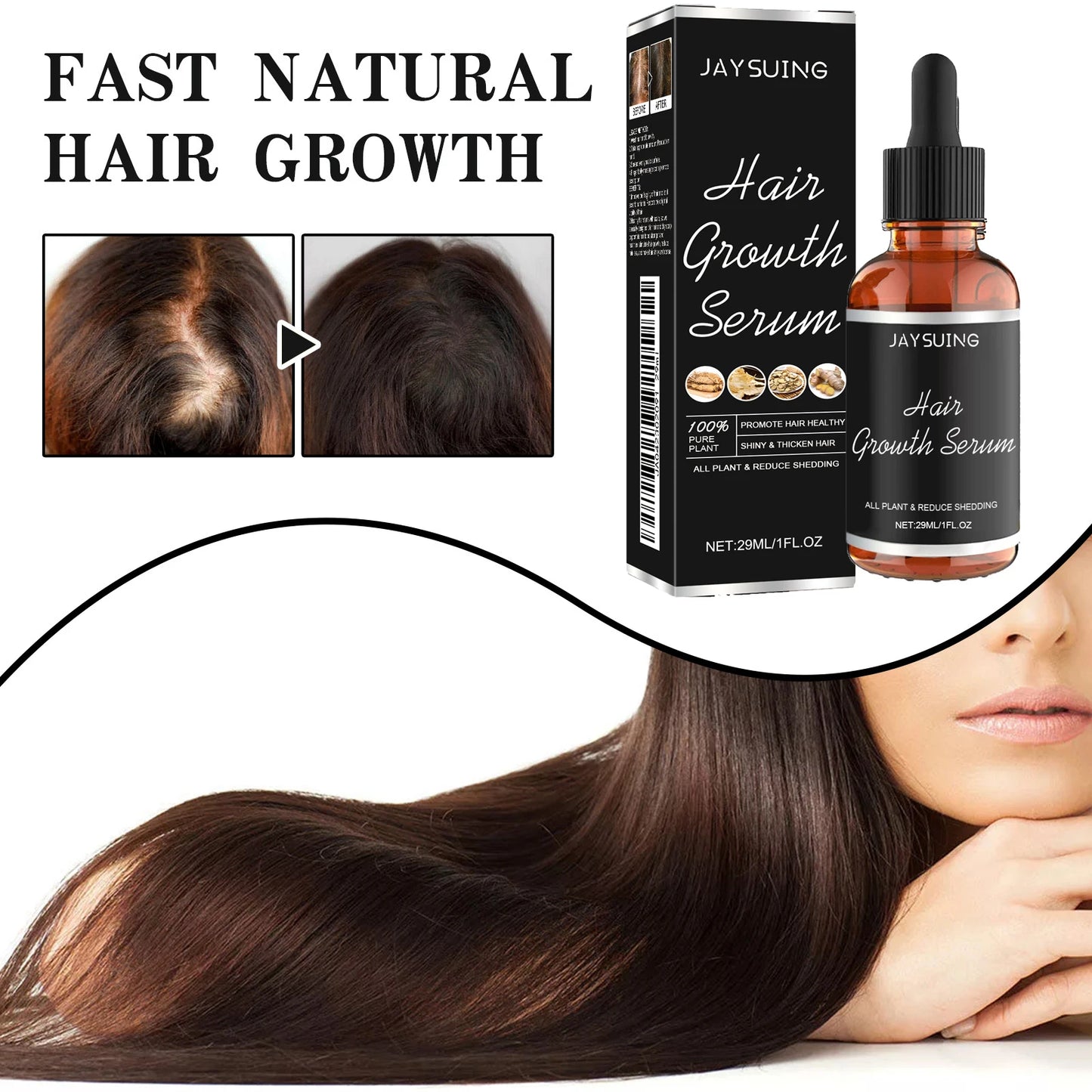 Jaysuing Hair Loss Essence – Scalp Nourishing Regrowth Serum