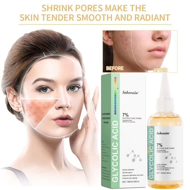 Glycolic Acid 7% Toning Solution Ordinary Acne Remover Lifting Firming Wrinkles Glowing Facial Skin Care Glycolic Acid Toner Peaceful Pleasures Health and Wellness