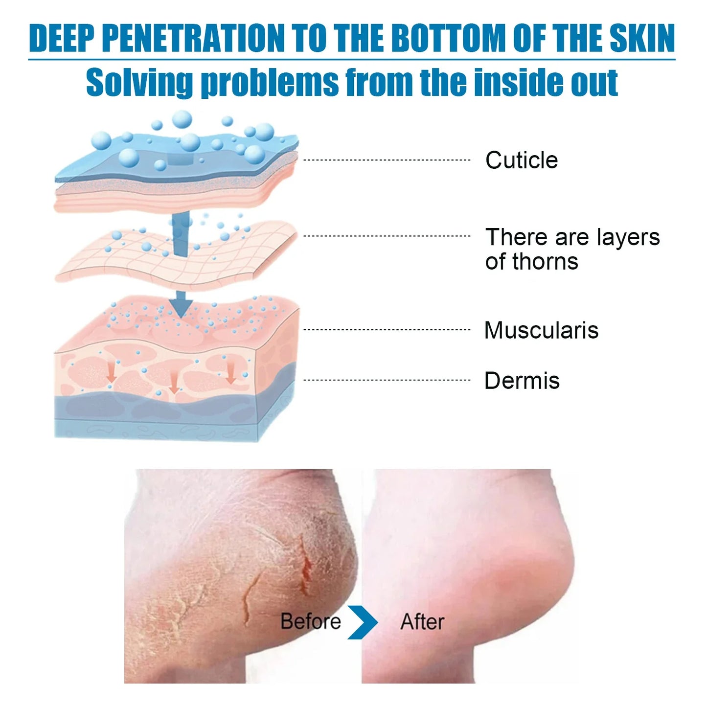 Exfoliating Foot Peel Mask – Callus & Dead Skin Remover