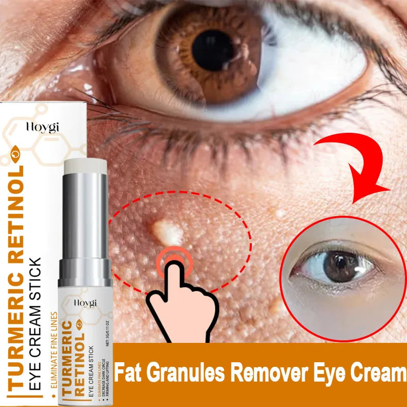 Hoygi Eye Cream | Dark Circles, Puffiness & Fine Lines