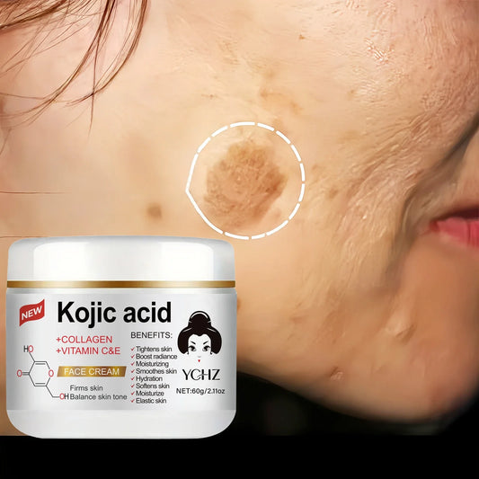YCHZ Kojic Acid Brightening Cream 60g – Even Skin Tone & Glow Brightening Face Cream Oasis Select