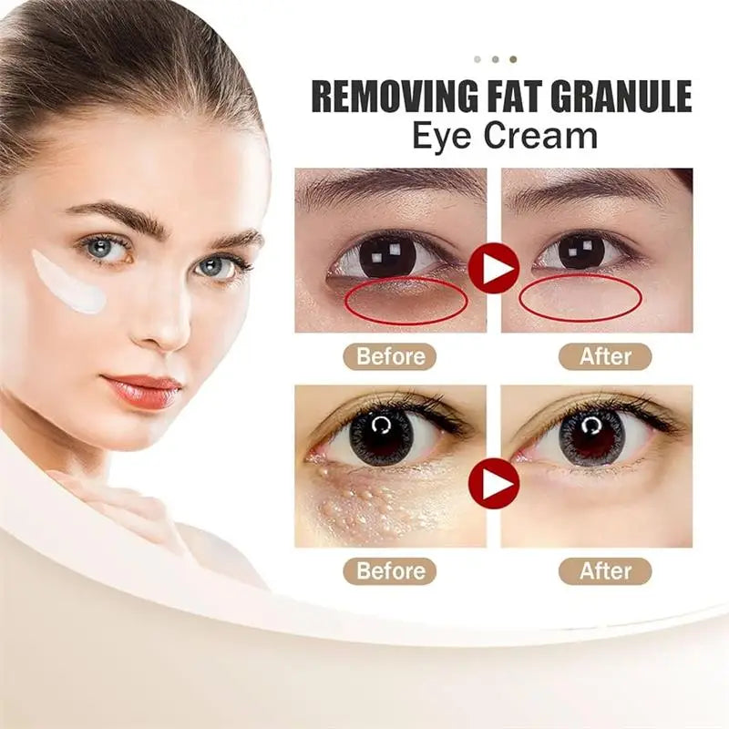 Hoygi Eye Cream | Dark Circles, Puffiness & Fine Lines