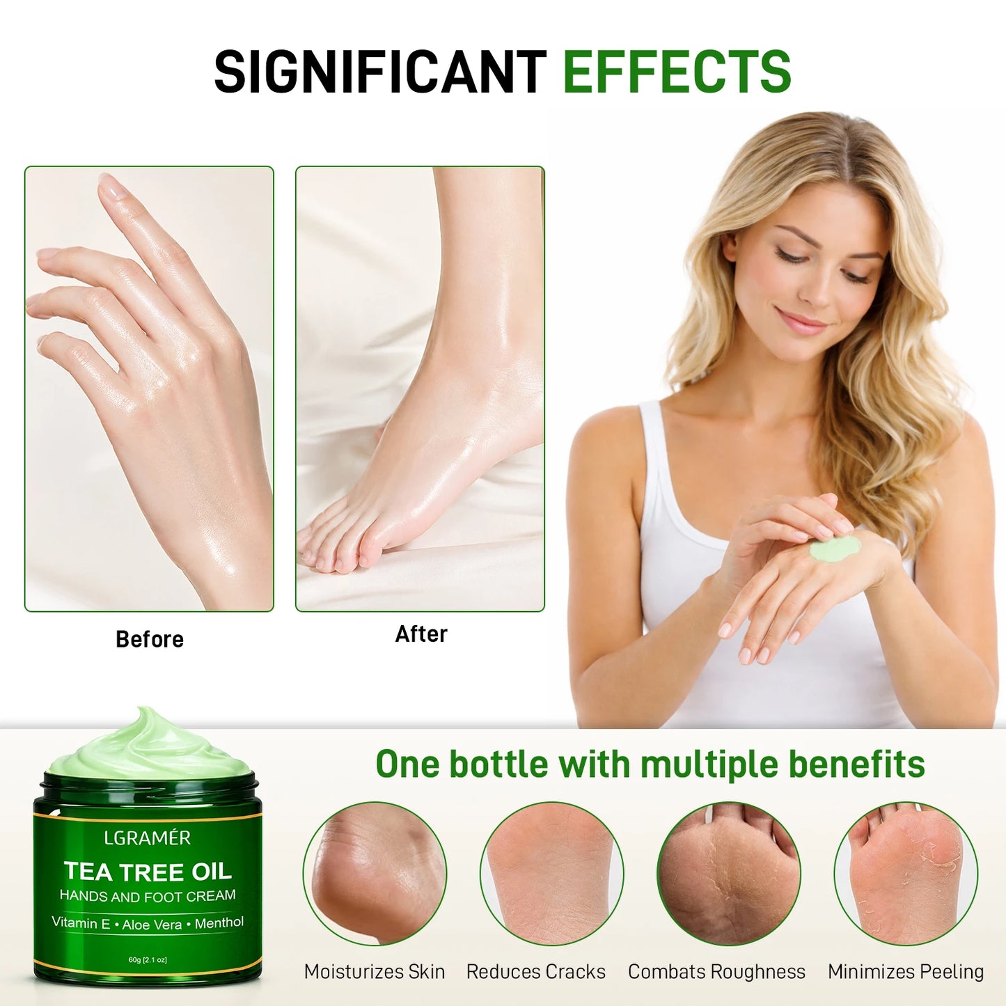 Tea Tree Oil Foot Cream – Heels, Calluses & Dry Skin | LGRAMER