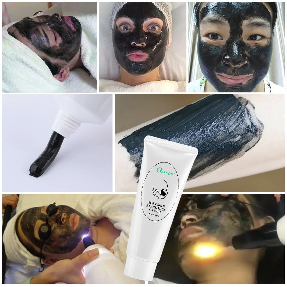 5/3 Carbon Gel Black Face Cream Mask Facial Deep Cleaning Support Laser Active Nano Toner Skin Rejuvenation Whitening Care Tool Peaceful Pleasures Health and Wellness