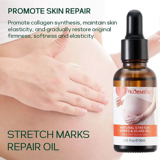 BIOAOUA Stretch Mark Oil Serum – Improve Skin Elasticity Body Oil Serum Oasis Select 1PCS