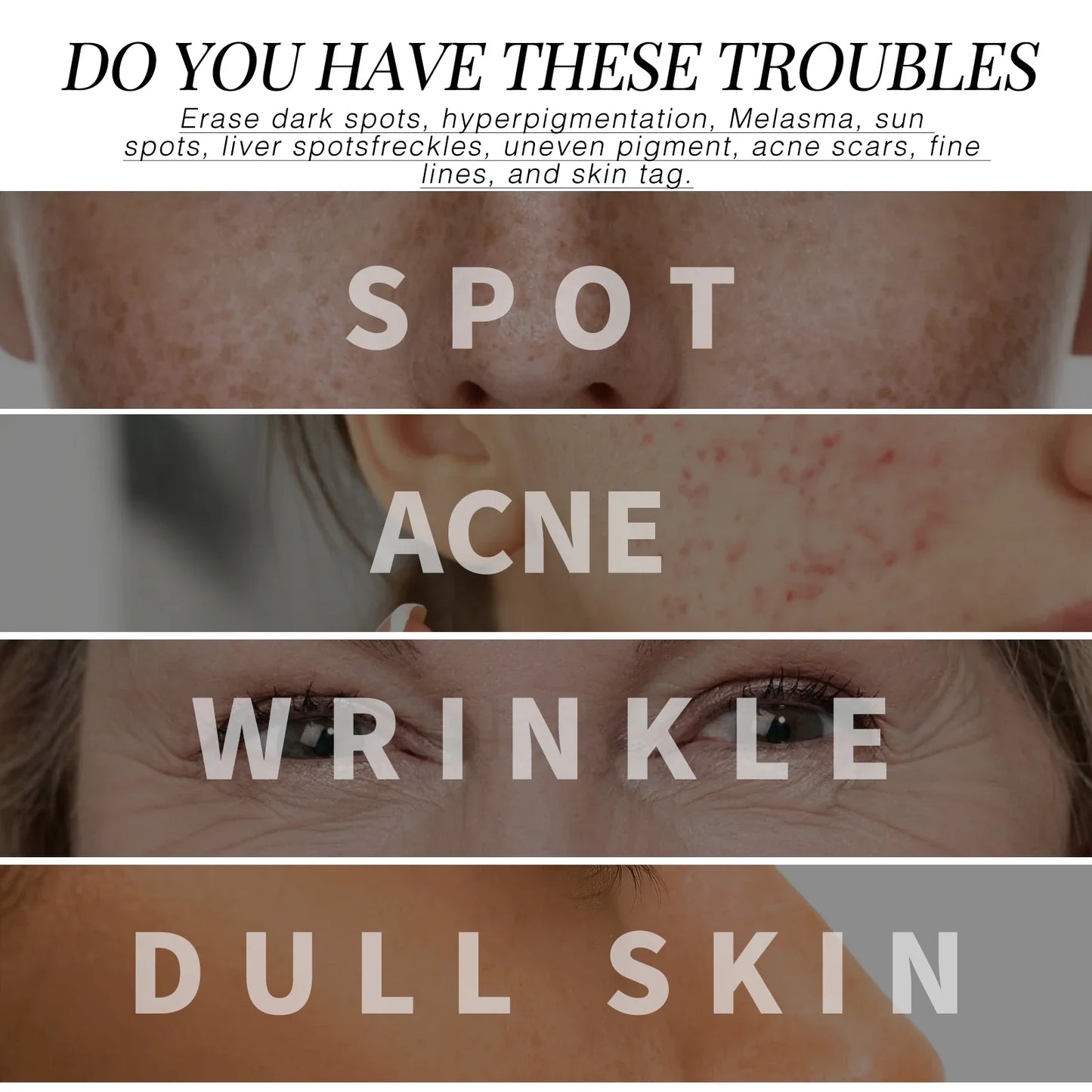 Eelhoe Retinol Anti-Aging Face Cream – Wrinkle & Pore Care