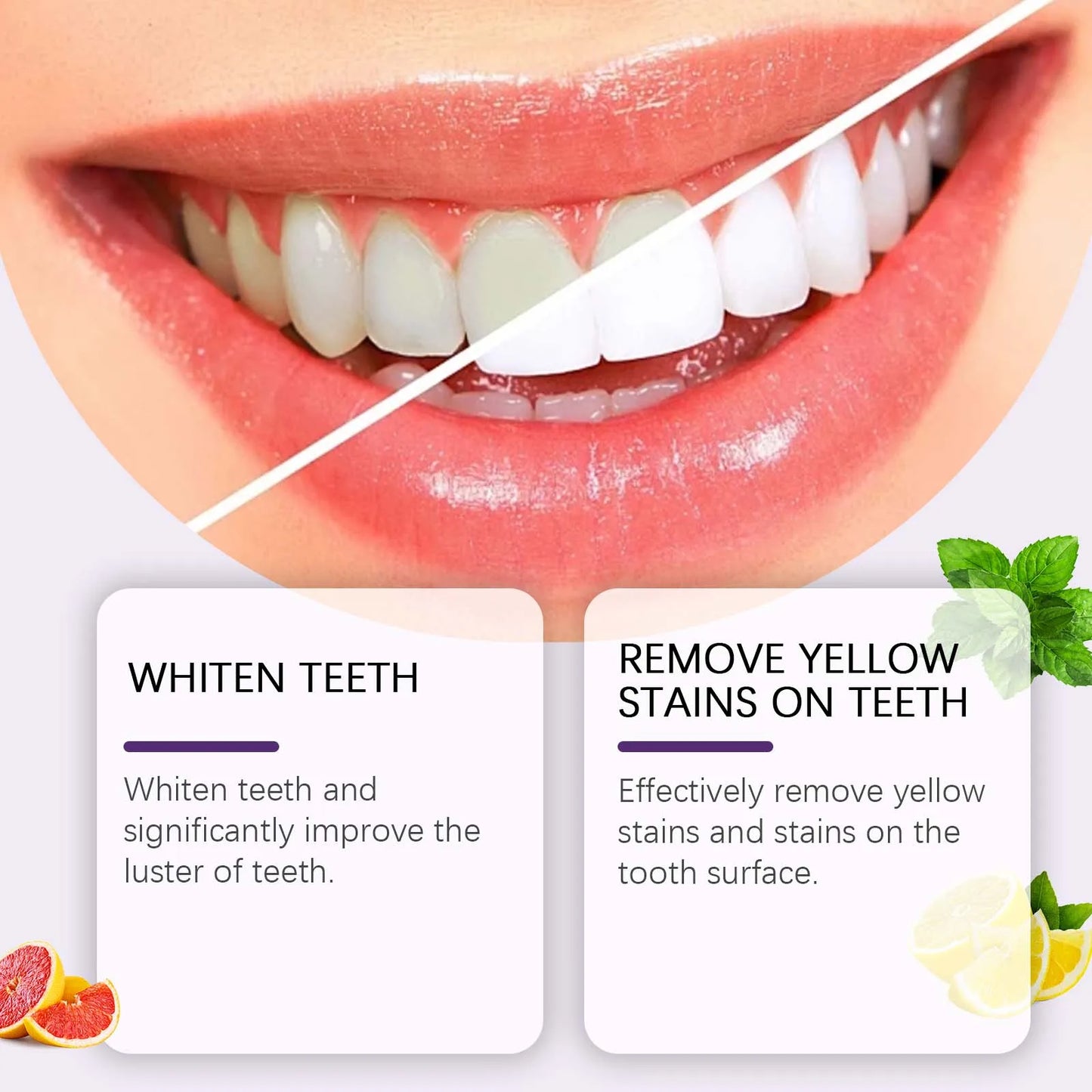 Oralhoe 120g Whitening Toothpaste | Gentle Stain Removal