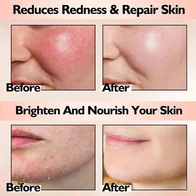 SADOER B5 Repair Cream – Vitamin B5 & Centella Moisturizer 40g