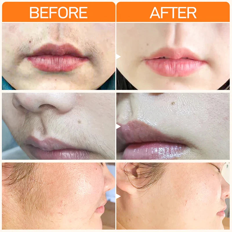 JoyPretty Hair Removal Cream – Legs, Arms & Intimate Areas