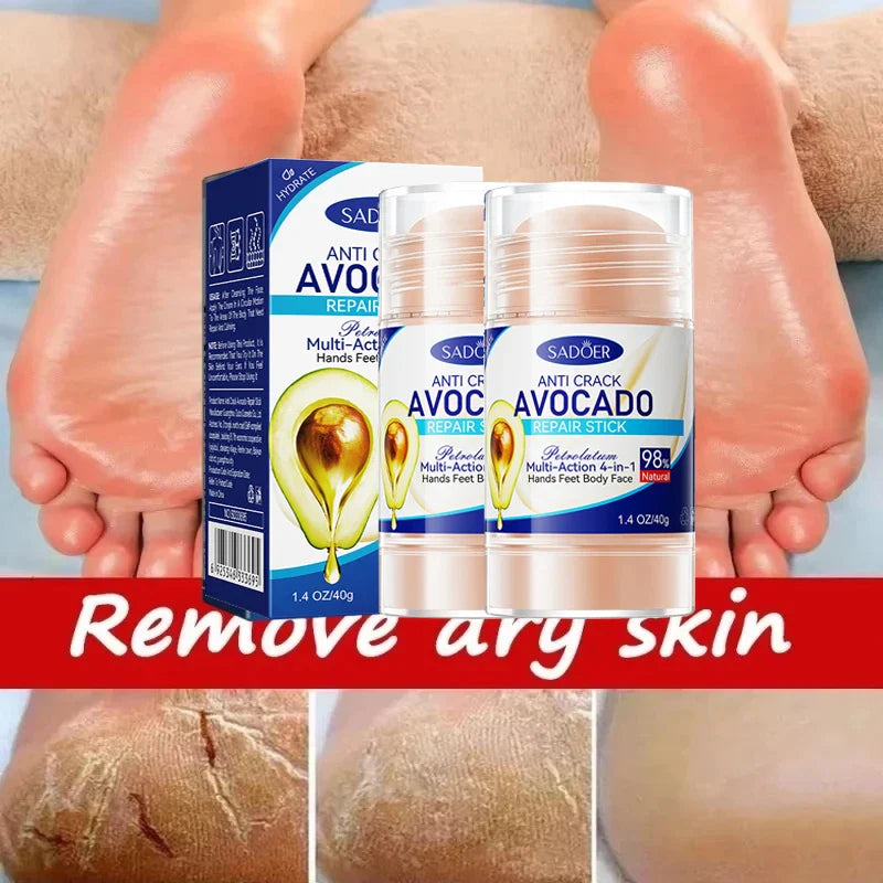 60% Urea Foot Cream with Aloe Vera – Deep Hydration 40g