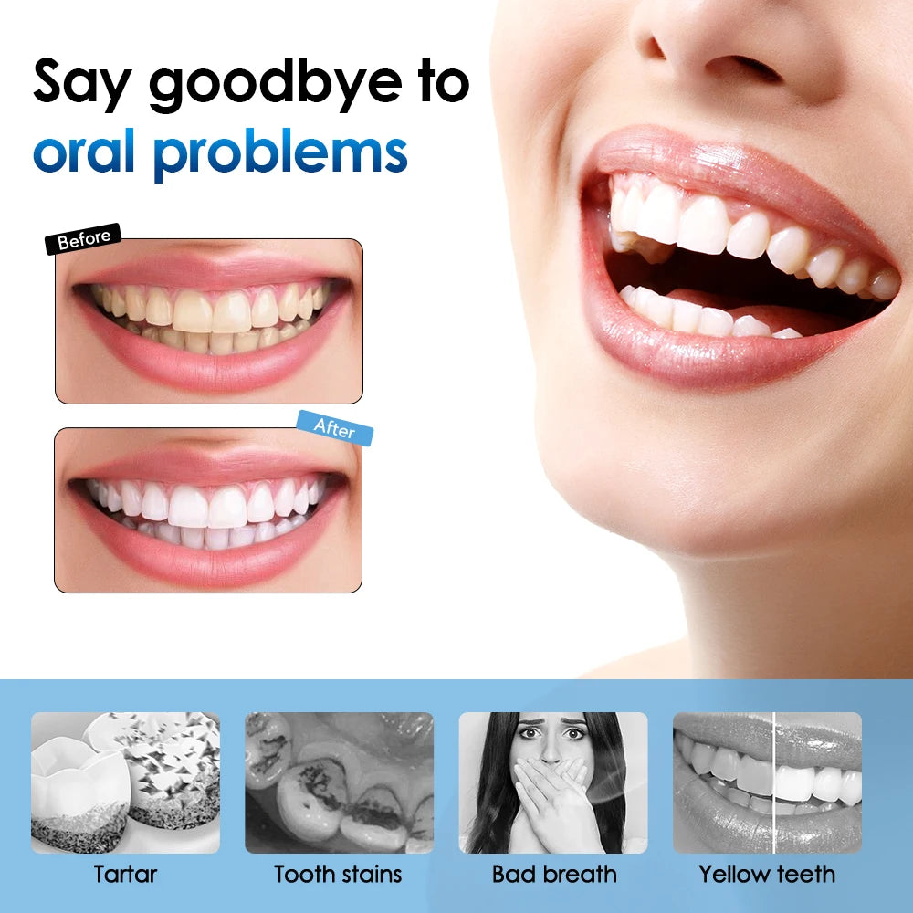 Electric Teeth Cleaner Remove Tartar Plaque Calculus and Tooth Stains Dental Teeth Whitening Kits With 6 Toothbrush Heads Home Peaceful Pleasures Health and Wellness