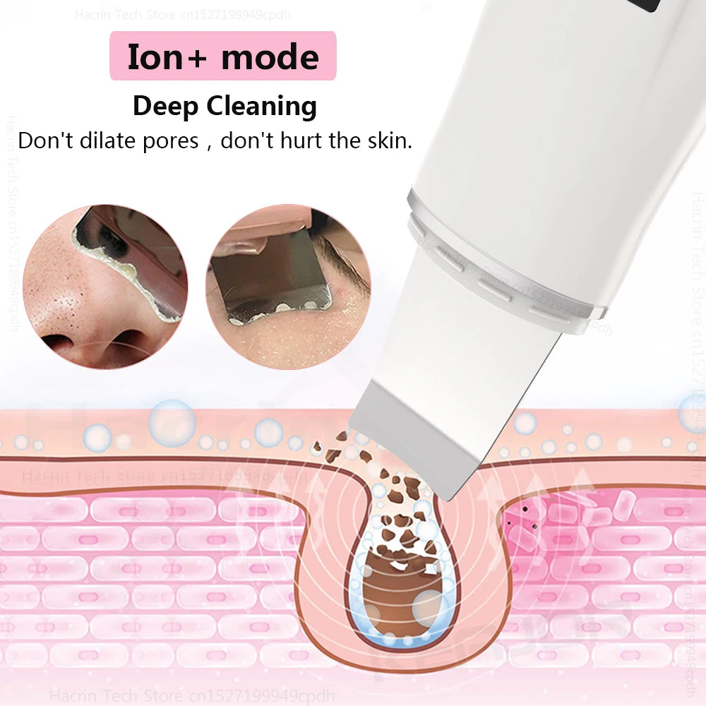 Ultrasonic Skin Scrubber Blackhead Remover Ultrasonic Peeling Pore Cleaner Face Cleaning Scrubber Ultrasonic Facial Espatula Peaceful Pleasures Health and Wellness