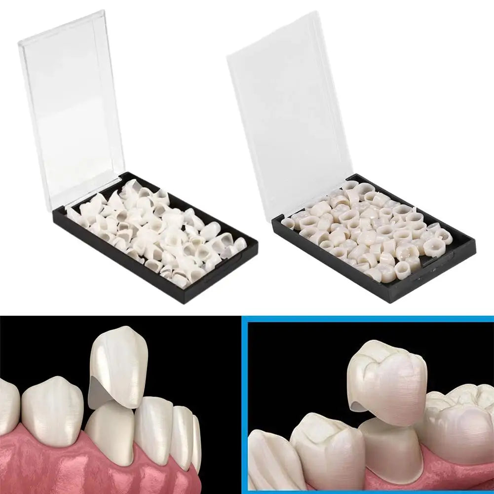 Temporary Dental Crowns | Anterior & Posterior Teeth Set Temporary Dental Crowns Peaceful Pleasures Health and Wellness
