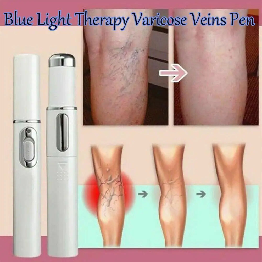 Skin Tag Removal Pen, Mole And Wart Removal Pen High-quality Anti Swelling Vessel Bulge Pain Blood Circulation Peaceful Pleasures Health and Wellness