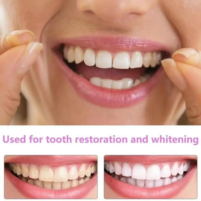 Snap-On Teeth Veneers – Reusable Smile Cover for Men & Women