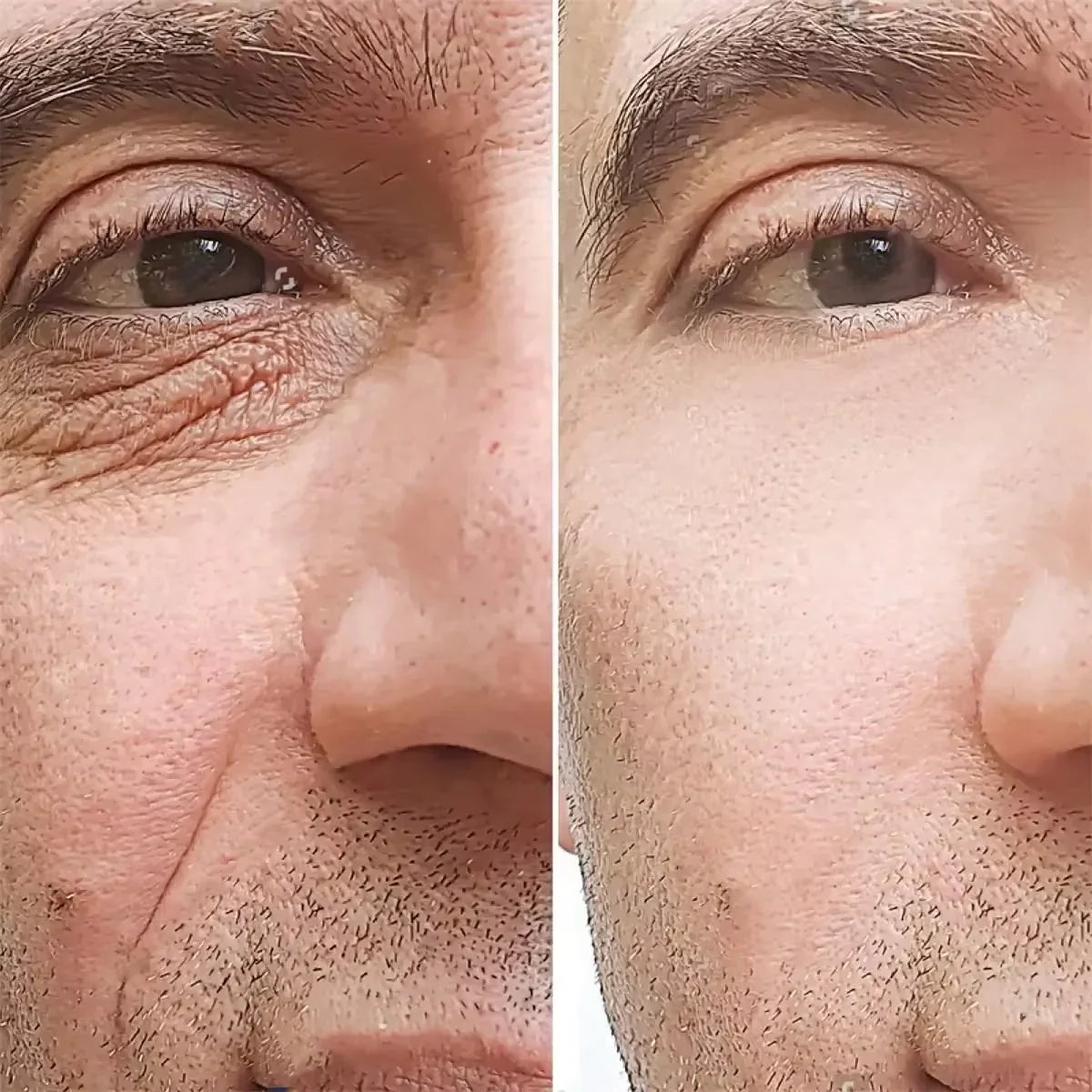 Retinol Eye Cream for Men – Firming & Brightening | 15g