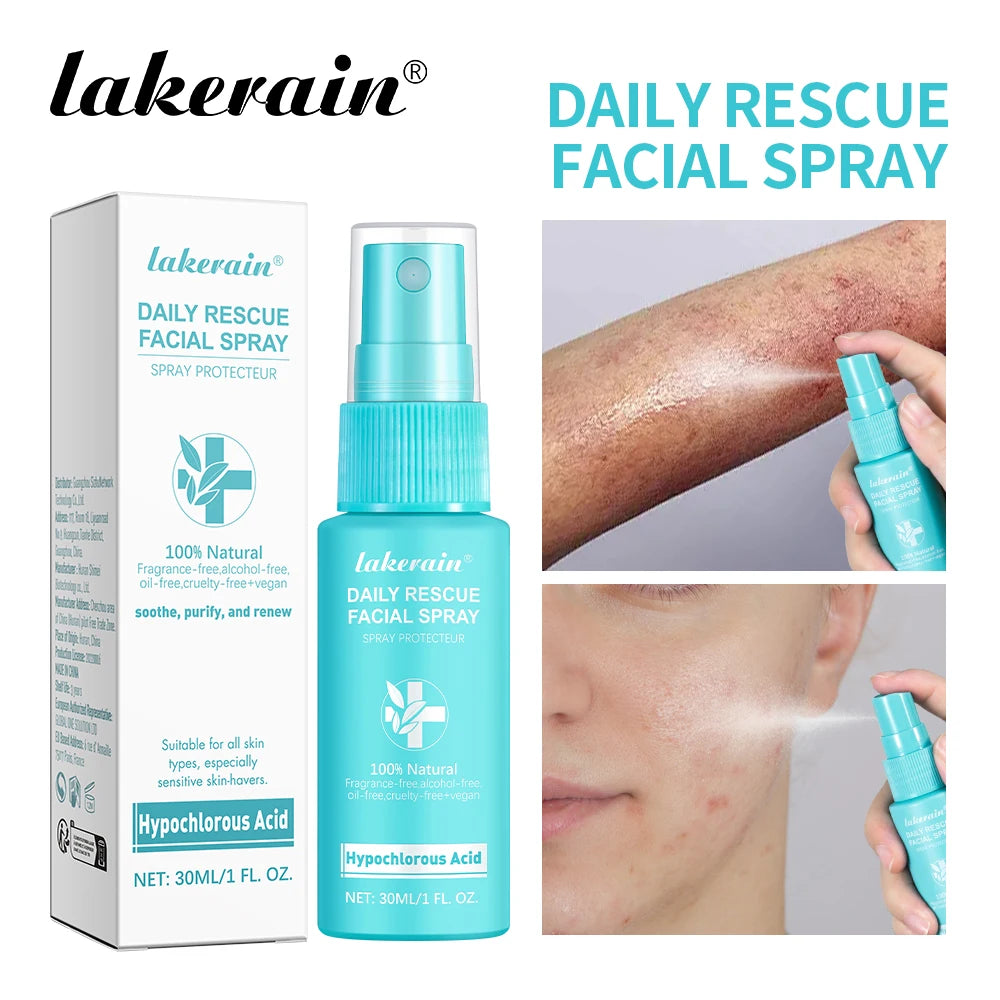 30ml Rescue Facial Spray For Sensitive Skin Hypochlorous Acid Spray Helps Reduce Redness Breakouts Soothing Balancing Spray Peaceful Pleasures Health and Wellness