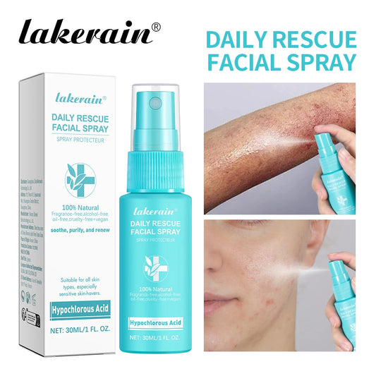 30ml Rescue Facial Spray For Sensitive Skin Hypochlorous Acid Spray Helps Reduce Redness Breakouts Soothing Balancing Spray Peaceful Pleasures Health and Wellness