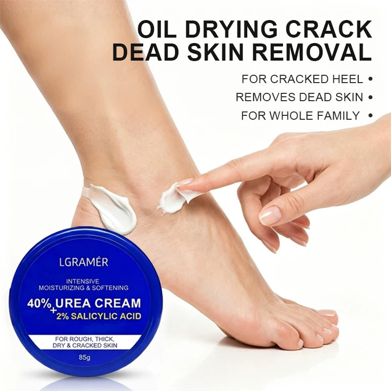40% Urea + 2% Salicylic Acid Foot & Hand Cream | Cracked Heel