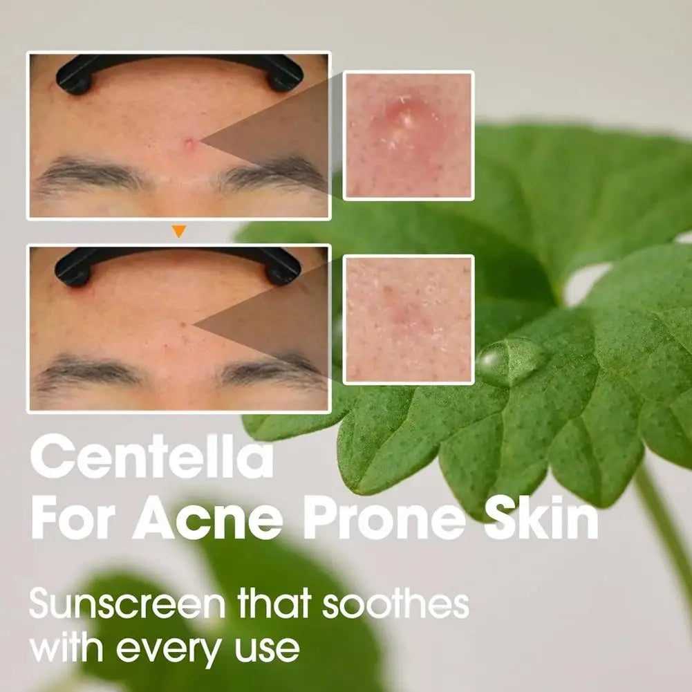 SOME BY MI AHA BHA PHA 30 Days Miracle Skin Care Lotion Face Cream and Cleanser Made from Tea Tree Leaf Water for Sensitive Skin Peaceful Pleasures Health and Wellness