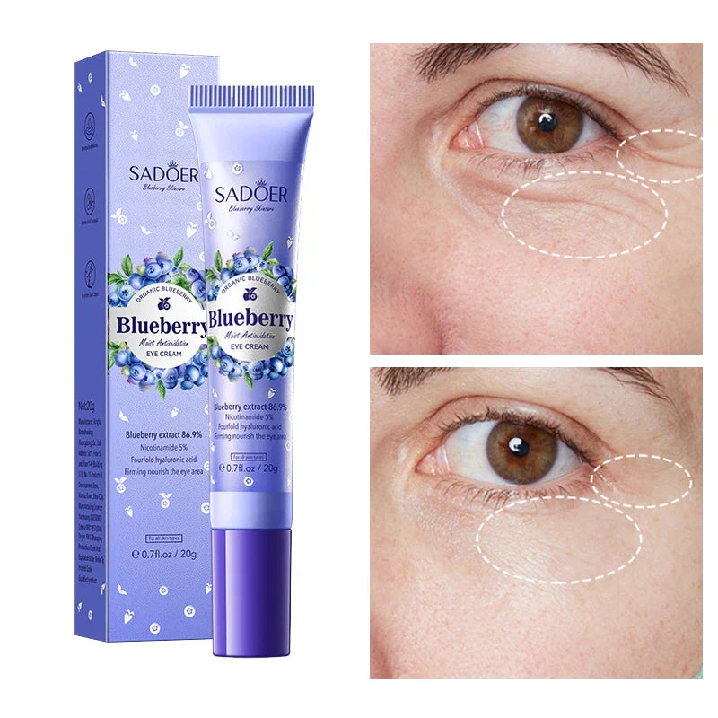 Blueberry Eye Cream – Moisturizing, Firming & Brightening