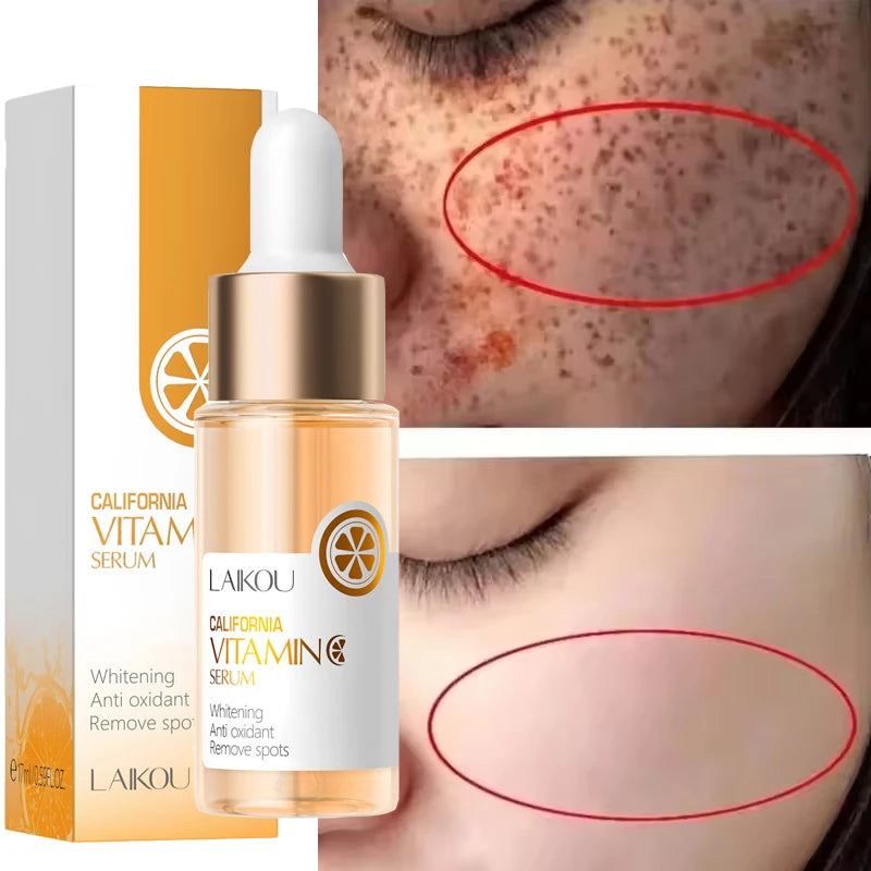 Vitamin C Whitening Serum Freckle Remove Essence Fade Pigmentation Melasma Dark Spots Corrector Repair Serum Korean Skin Care Peaceful Pleasures Health and Wellness